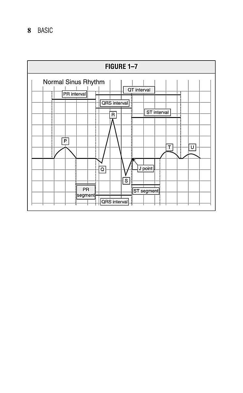 Interpreting EKG EKG Interpretation For Nurses EKG Interpretation Practice EKG Interpretation Book - photo 12