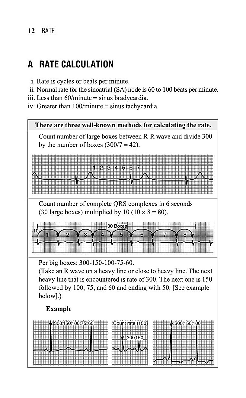 Interpreting EKG EKG Interpretation For Nurses EKG Interpretation Practice EKG Interpretation Book - photo 15