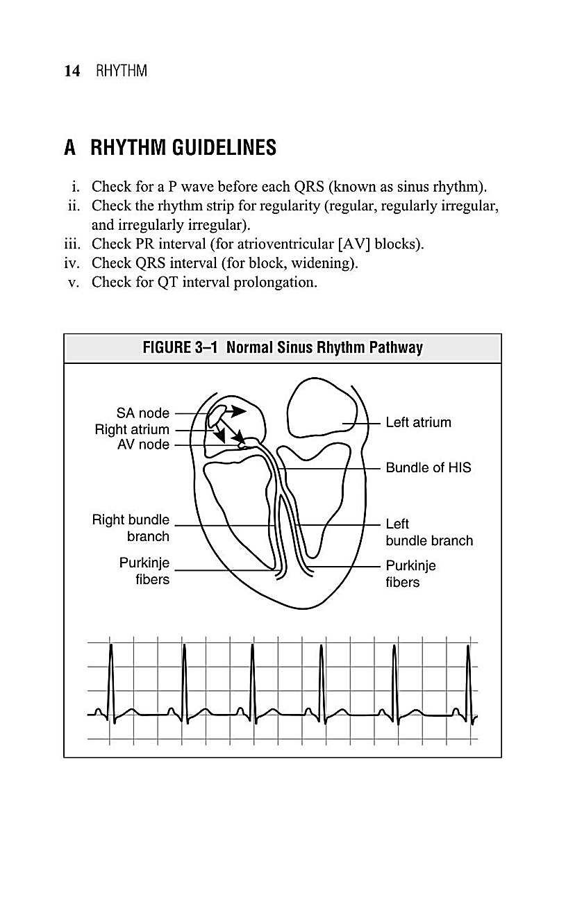 Interpreting EKG EKG Interpretation For Nurses EKG Interpretation Practice EKG Interpretation Book - photo 17