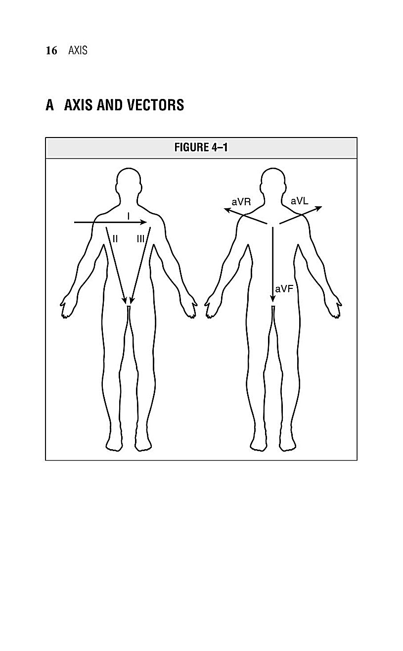 Interpreting EKG EKG Interpretation For Nurses EKG Interpretation Practice EKG Interpretation Book - photo 19