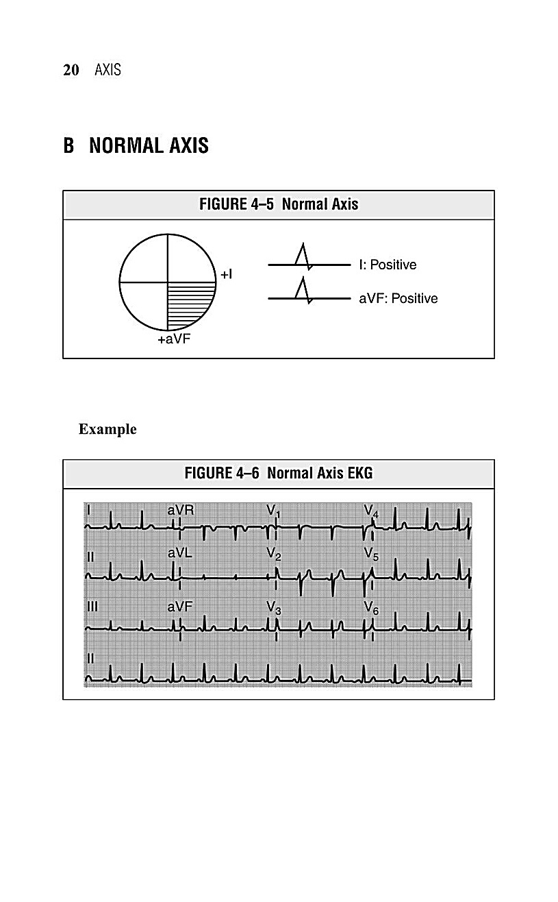 Interpreting EKG EKG Interpretation For Nurses EKG Interpretation Practice EKG Interpretation Book - photo 23