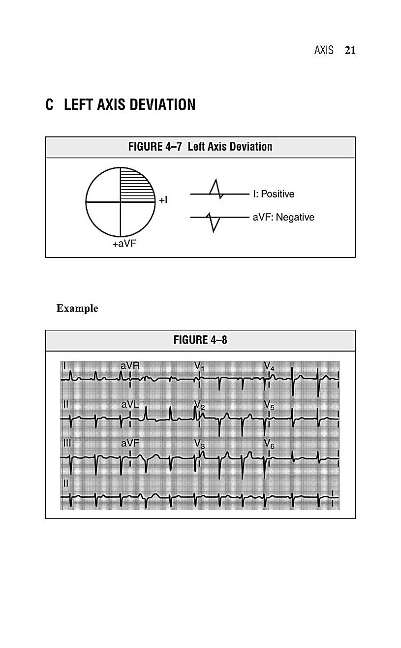 Interpreting EKG EKG Interpretation For Nurses EKG Interpretation Practice EKG Interpretation Book - photo 24