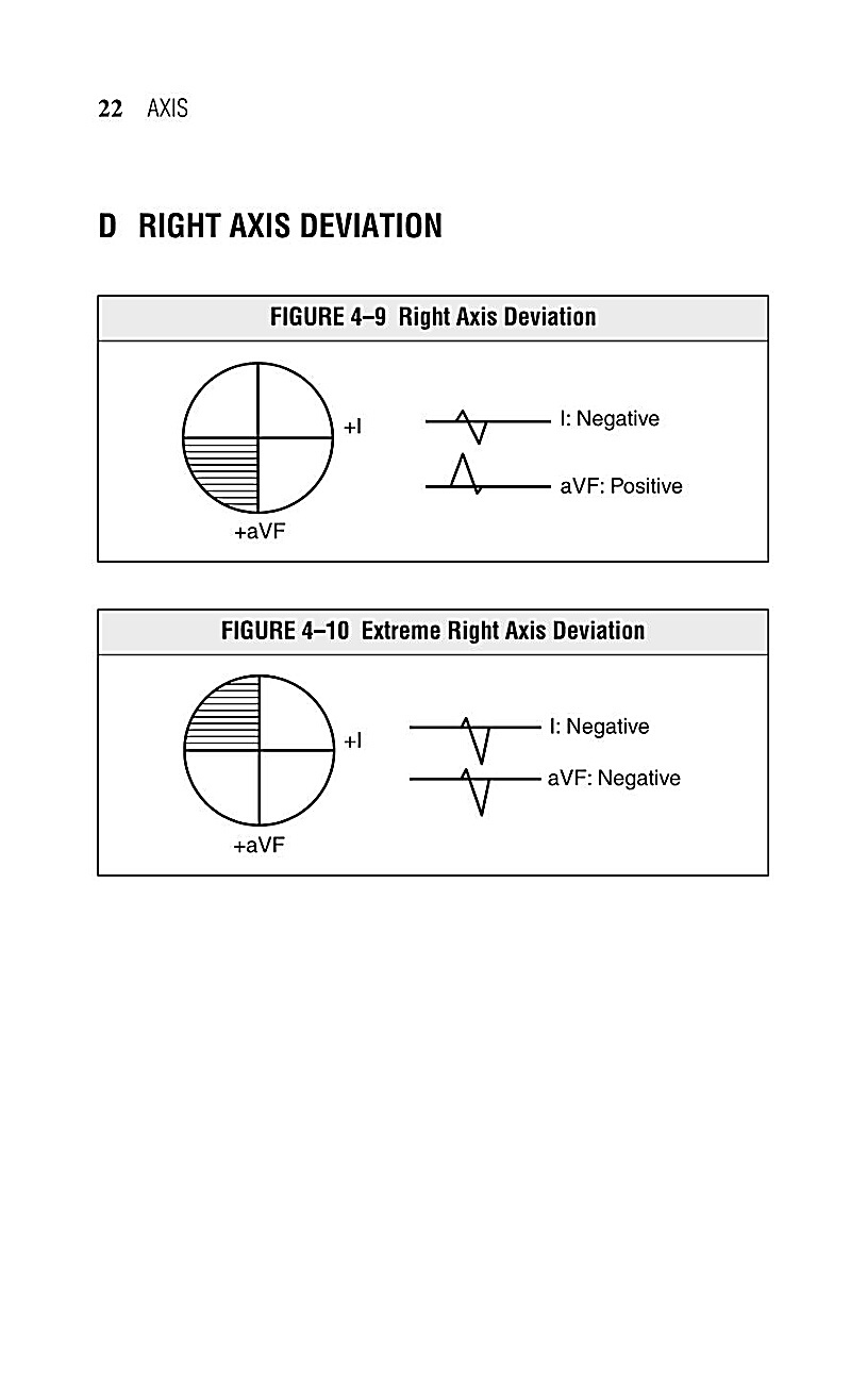 Interpreting EKG EKG Interpretation For Nurses EKG Interpretation Practice EKG Interpretation Book - photo 25