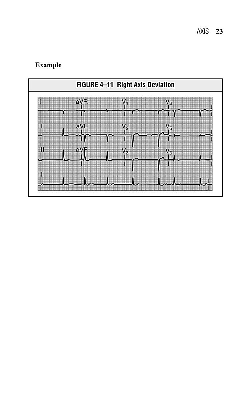 Interpreting EKG EKG Interpretation For Nurses EKG Interpretation Practice EKG Interpretation Book - photo 26