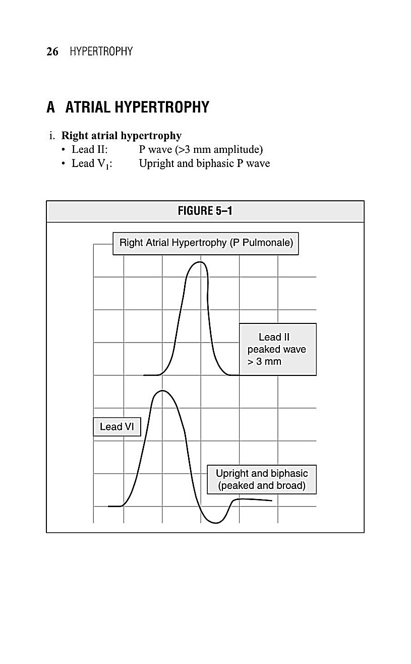 Interpreting EKG EKG Interpretation For Nurses EKG Interpretation Practice EKG Interpretation Book - photo 28