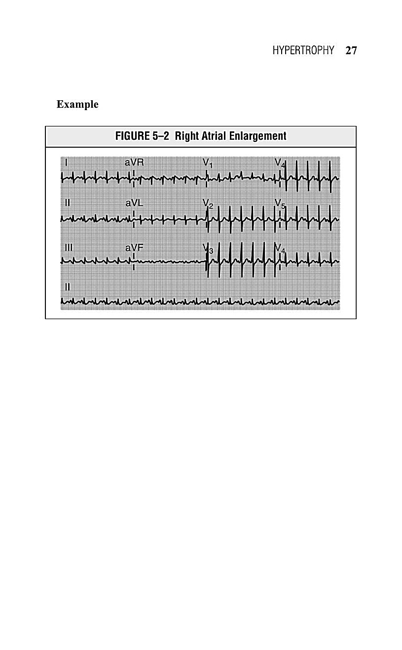 Interpreting EKG EKG Interpretation For Nurses EKG Interpretation Practice EKG Interpretation Book - photo 29