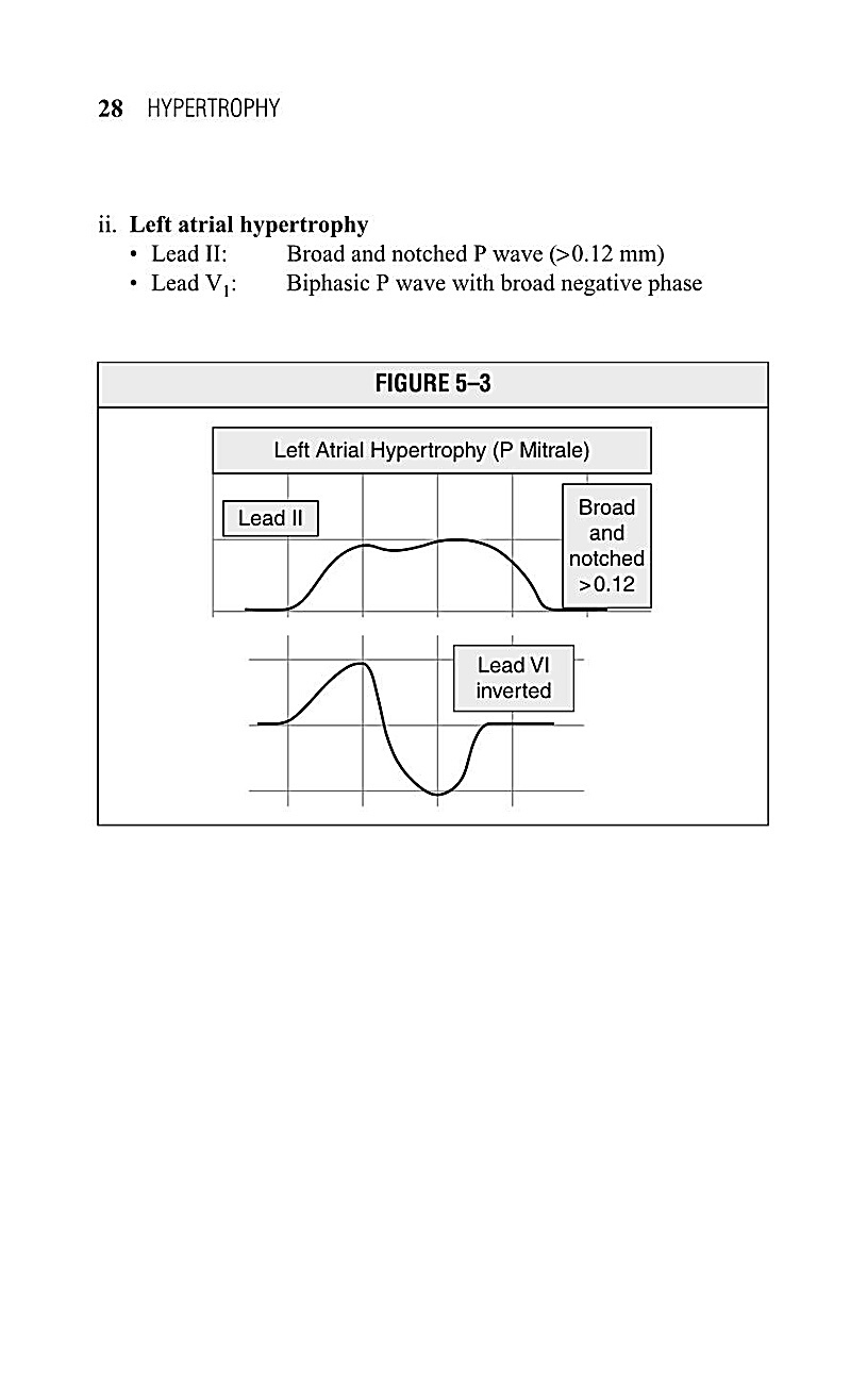 Interpreting EKG EKG Interpretation For Nurses EKG Interpretation Practice EKG Interpretation Book - photo 30