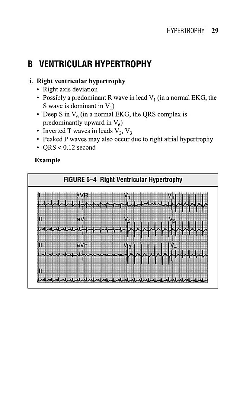 Interpreting EKG EKG Interpretation For Nurses EKG Interpretation Practice EKG Interpretation Book - photo 31