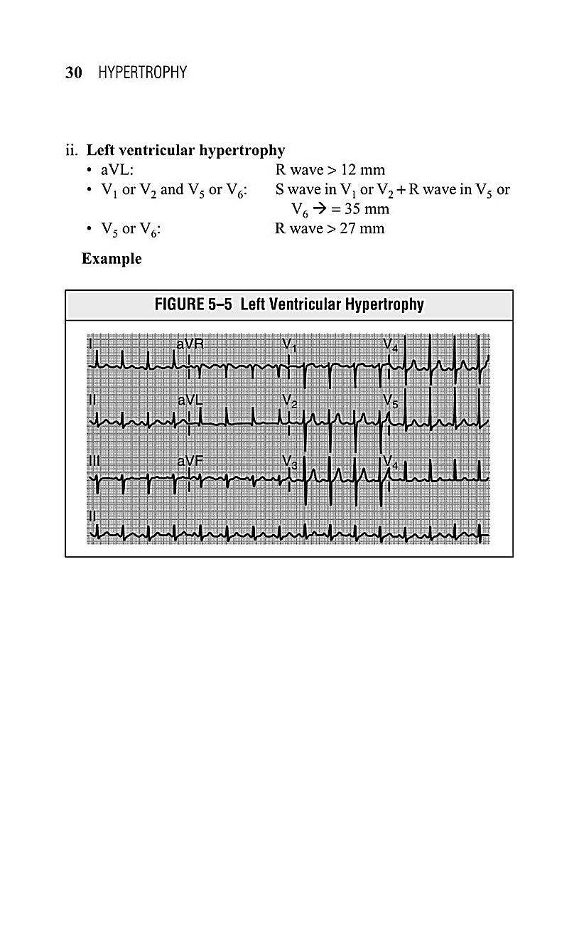 Interpreting EKG EKG Interpretation For Nurses EKG Interpretation Practice EKG Interpretation Book - photo 32