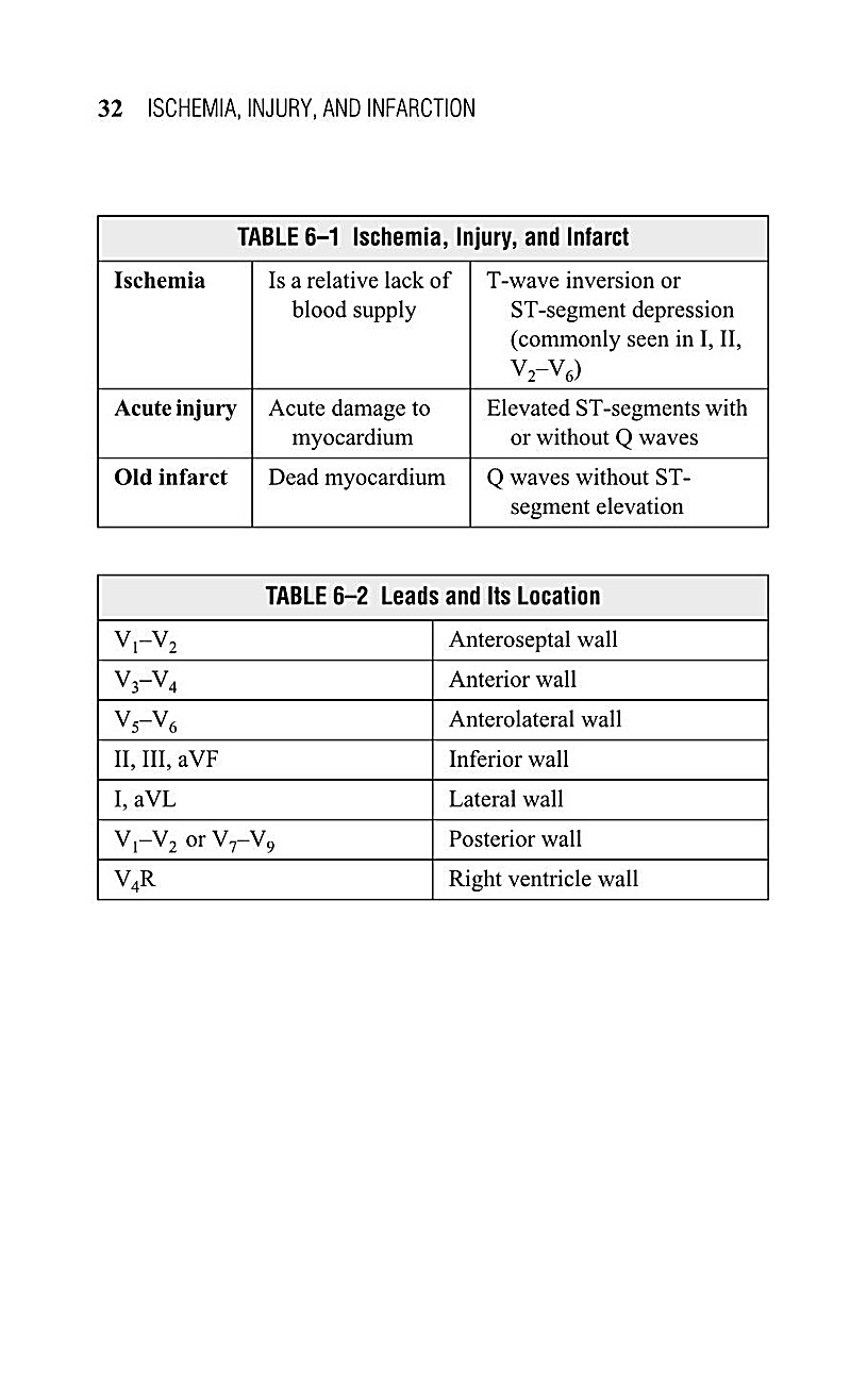 Interpreting EKG EKG Interpretation For Nurses EKG Interpretation Practice EKG Interpretation Book - photo 34