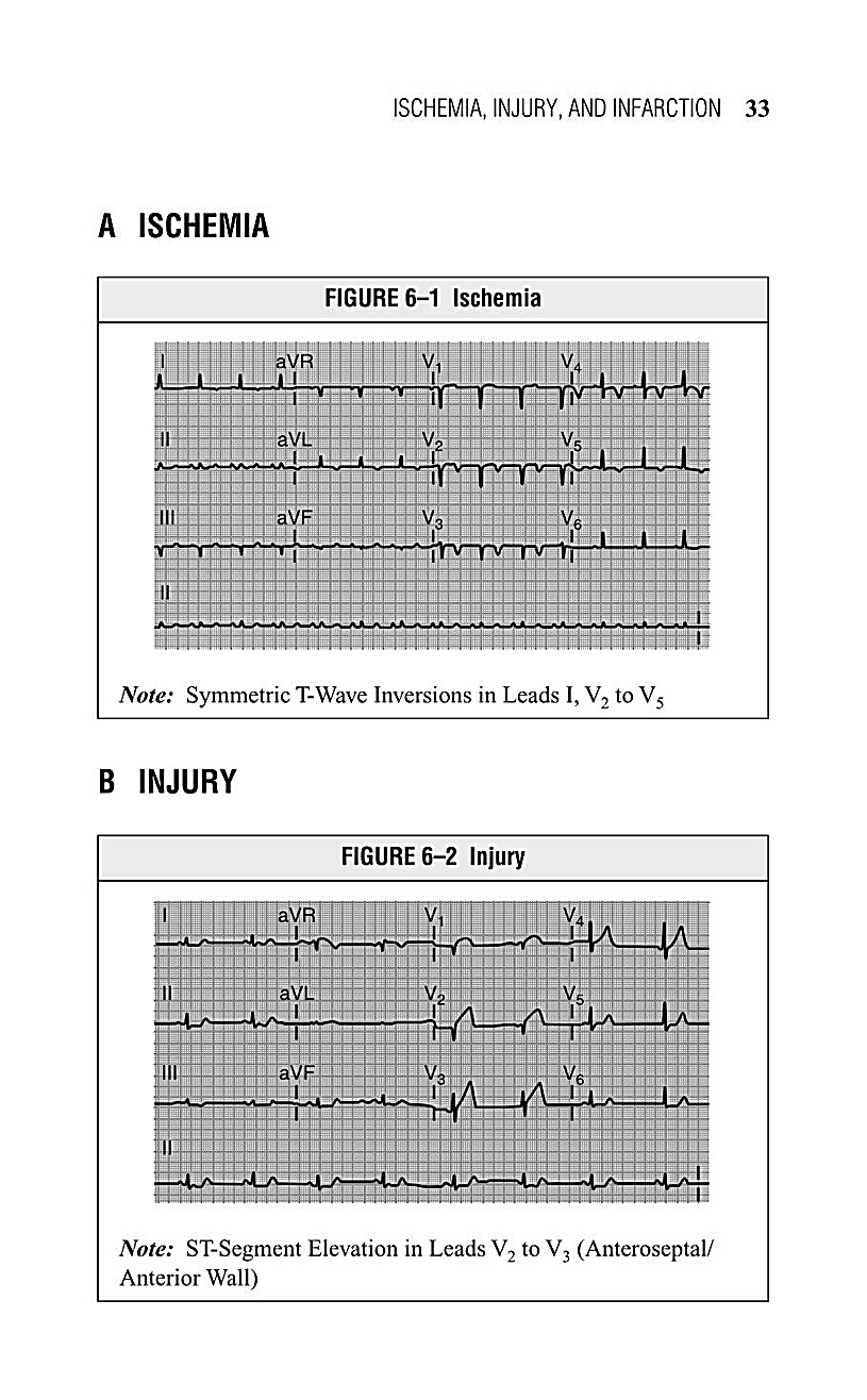 Interpreting EKG EKG Interpretation For Nurses EKG Interpretation Practice EKG Interpretation Book - photo 35