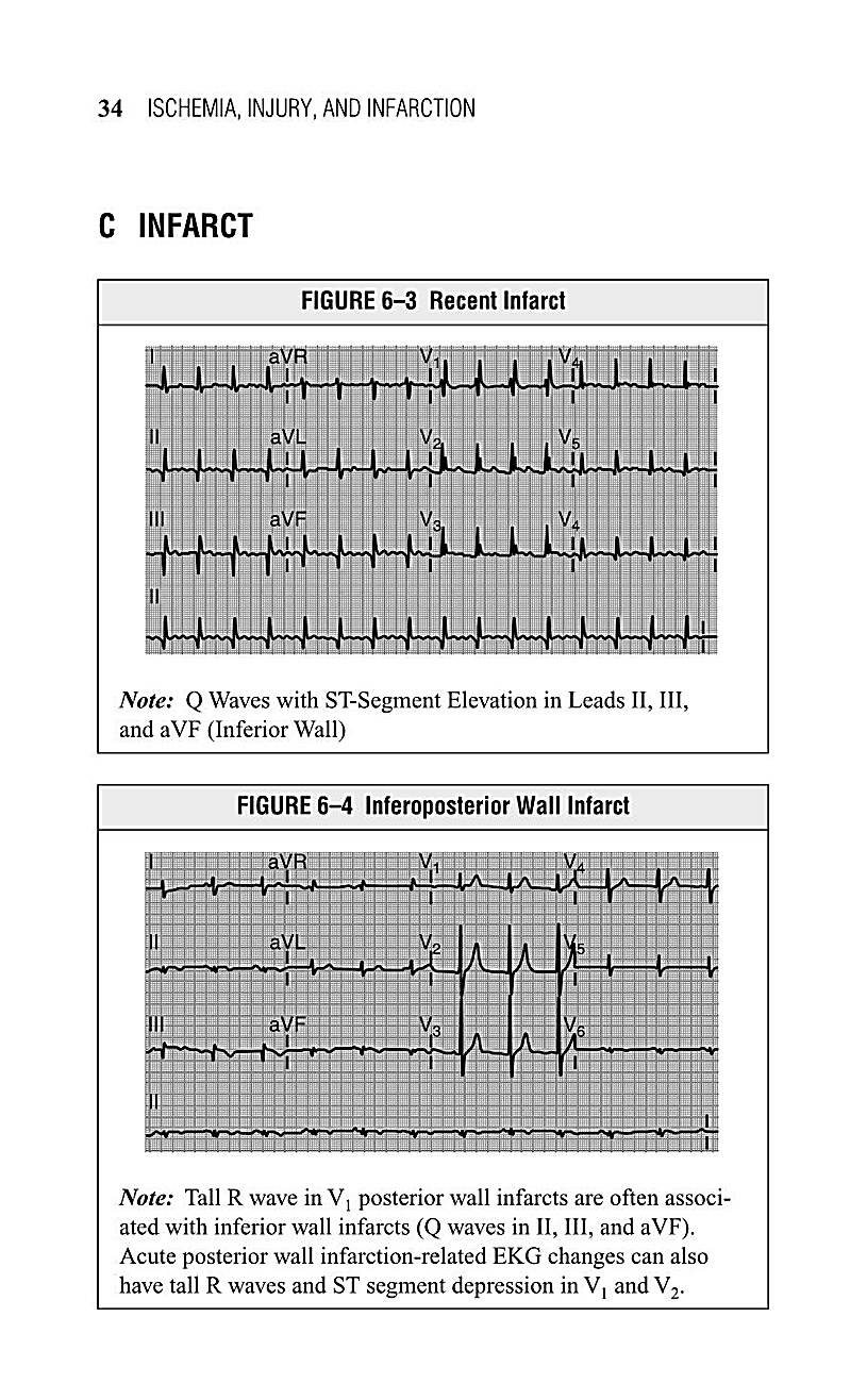 Interpreting EKG EKG Interpretation For Nurses EKG Interpretation Practice EKG Interpretation Book - photo 36