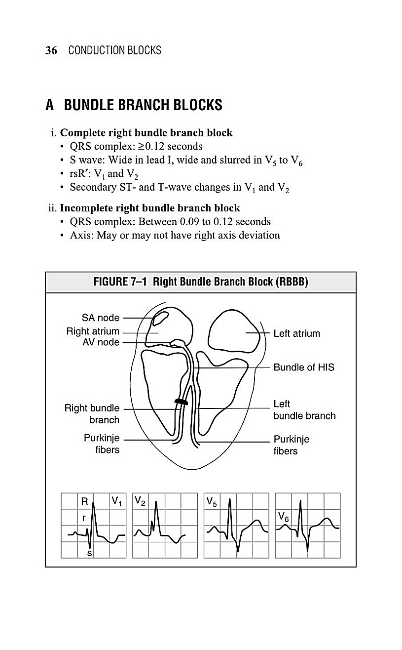 Interpreting EKG EKG Interpretation For Nurses EKG Interpretation Practice EKG Interpretation Book - photo 38