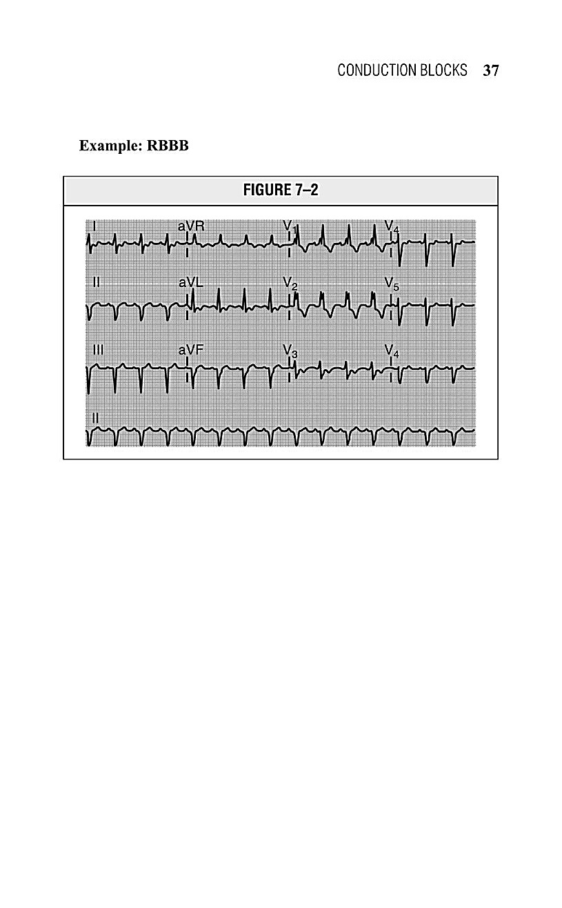 Interpreting EKG EKG Interpretation For Nurses EKG Interpretation Practice EKG Interpretation Book - photo 39