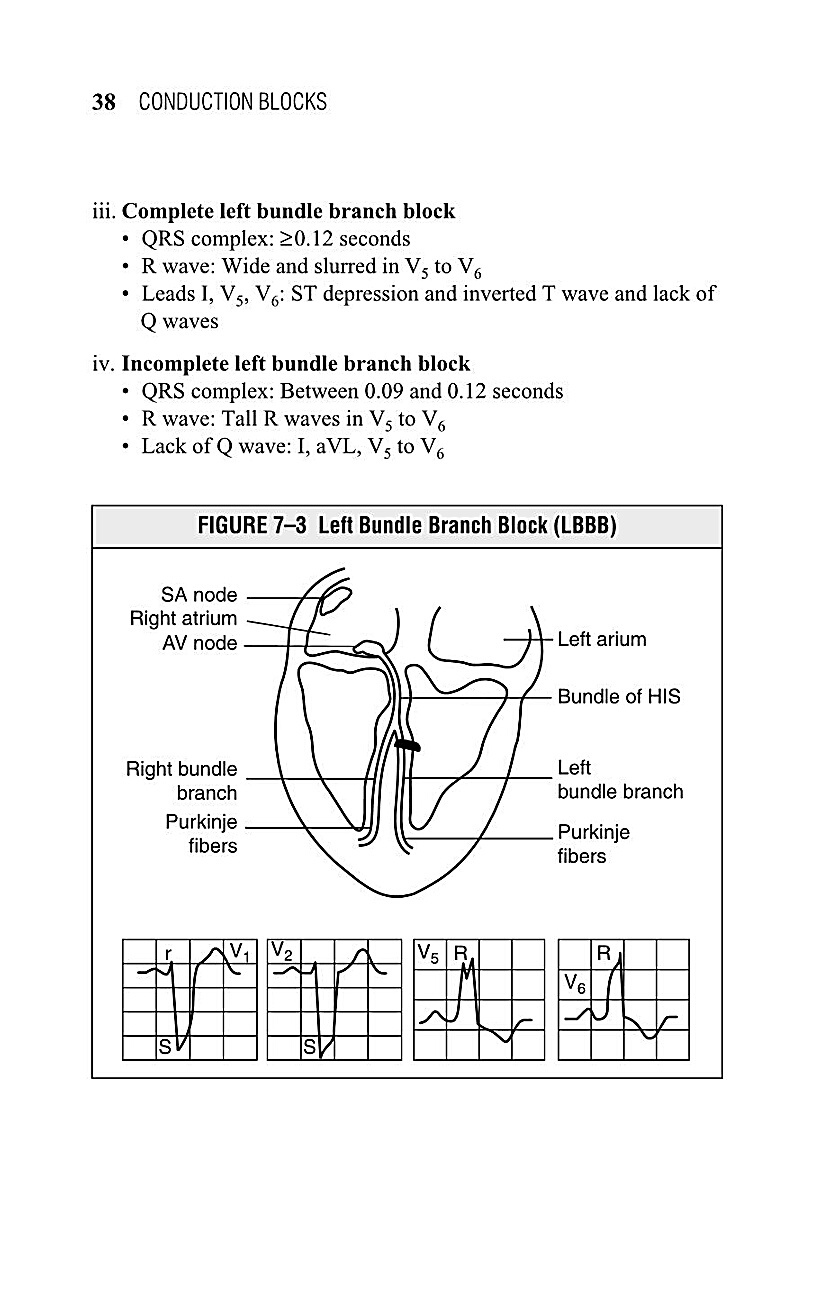 Interpreting EKG EKG Interpretation For Nurses EKG Interpretation Practice EKG Interpretation Book - photo 40