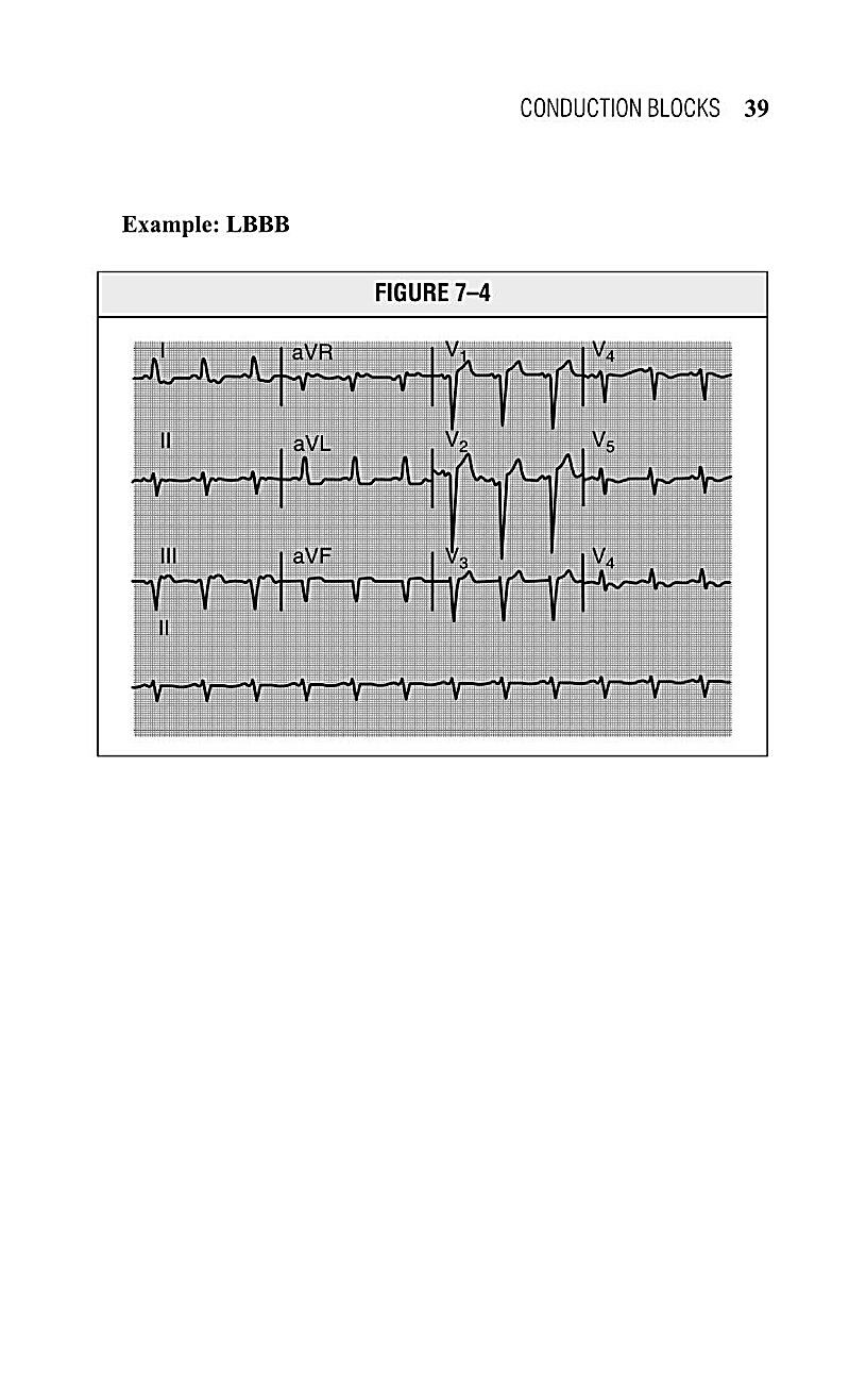 Interpreting EKG EKG Interpretation For Nurses EKG Interpretation Practice EKG Interpretation Book - photo 41