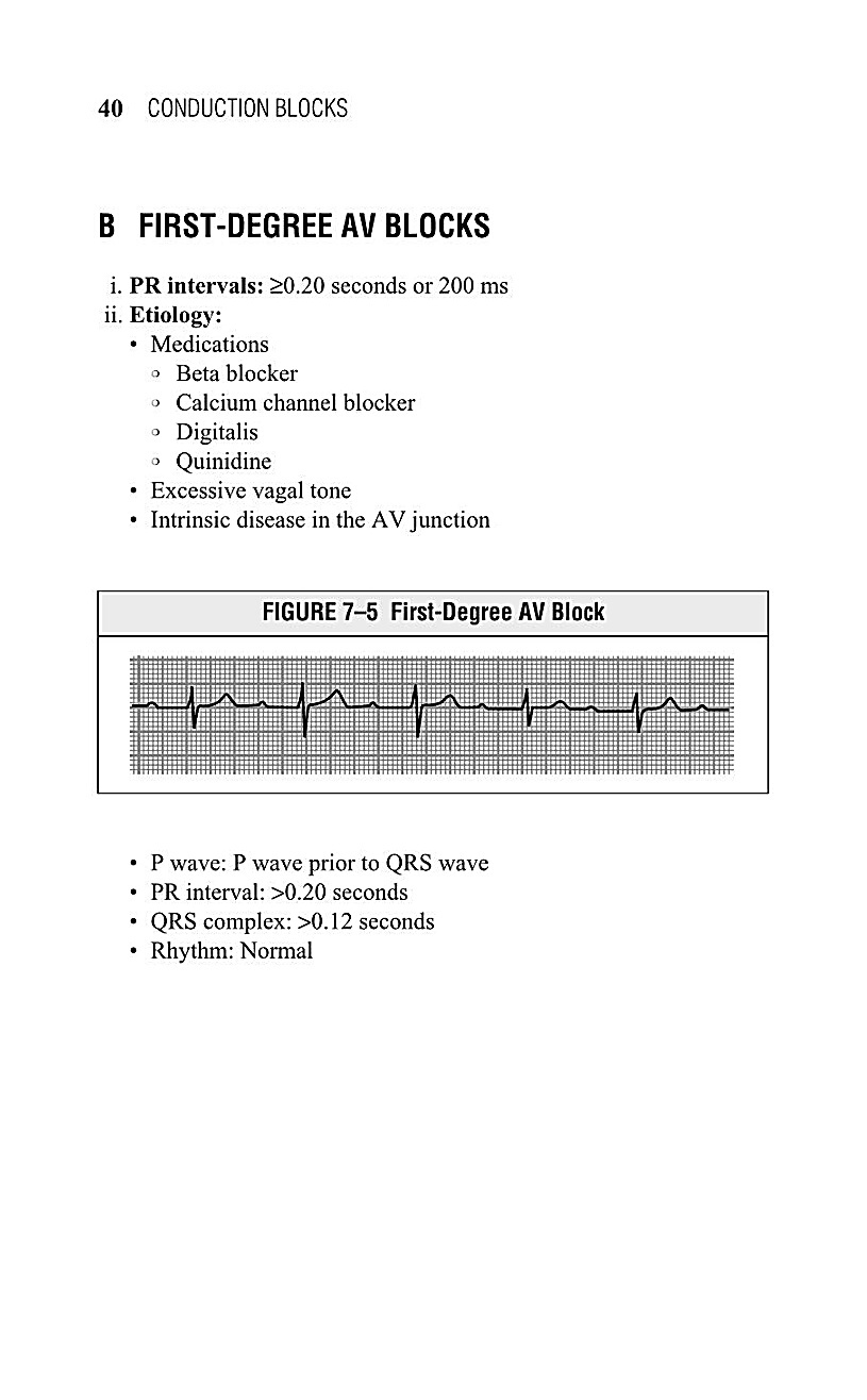 Interpreting EKG EKG Interpretation For Nurses EKG Interpretation Practice EKG Interpretation Book - photo 42