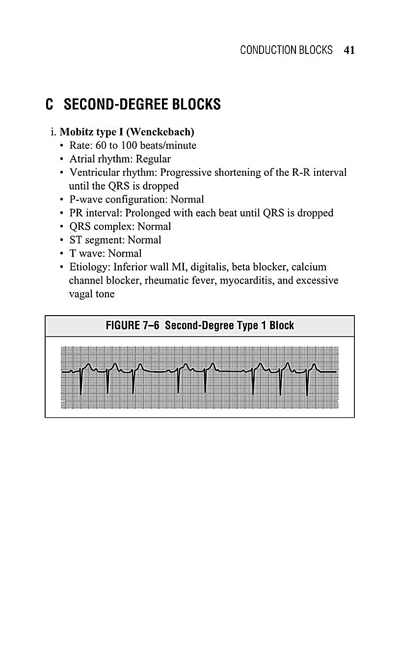 Interpreting EKG EKG Interpretation For Nurses EKG Interpretation Practice EKG Interpretation Book - photo 43