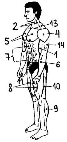 Fig 1 Muscle consists of striated muscle fibers the number of which - photo 1