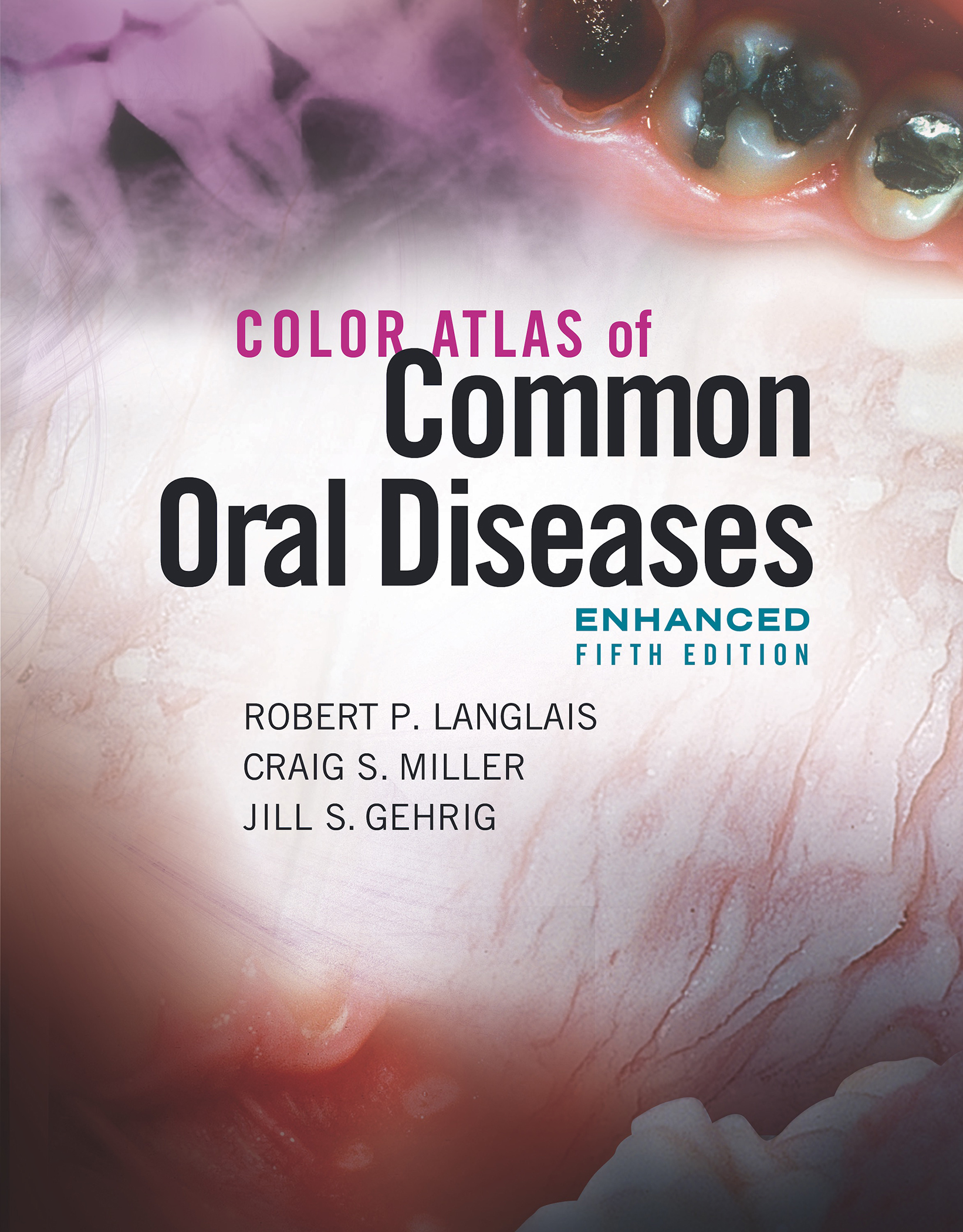 COLOR ATLAS OF Common Oral Diseases ENHANCED FIFTH EDITION COLOR ATLAS OF - photo 1