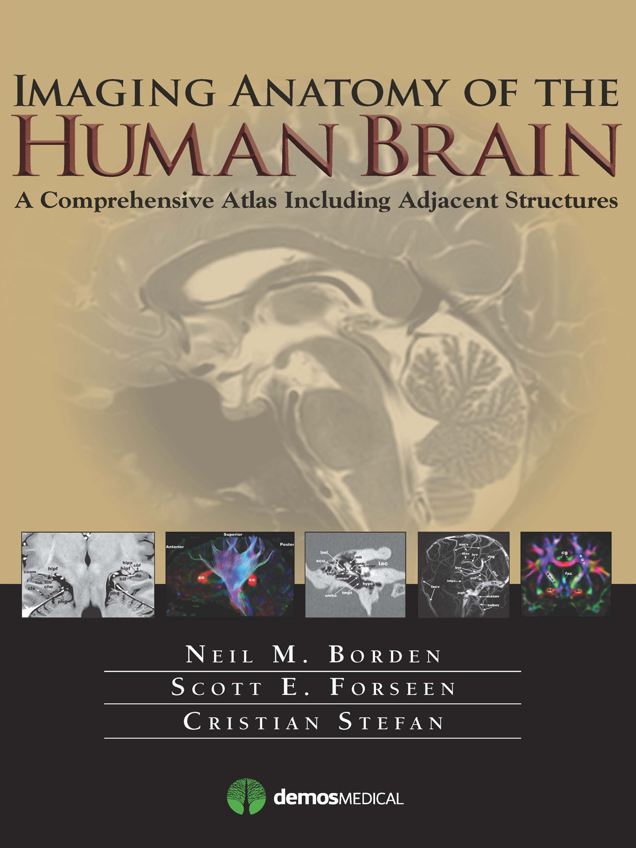 Imaging Anatomy of the Human Brain - photo 1
