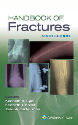 Kenneth Egol - Handbook of Fractures