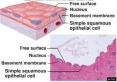 A simple squmous B simple columnar C stratified columnar D stratified - photo 2