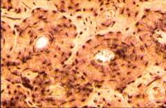 A Spongy Bone B bone osseous C reticular D dense irregular 13 Cells - photo 8