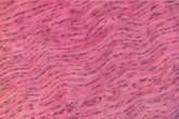 A Smooth Muscle B Skeletal Muscle C Dense Regular D Stratified squamous - photo 15