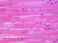 A Nervous B Epithelial C Connective D Muscle 21 The type of tissue - photo 16