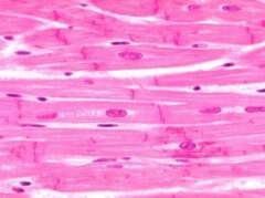 A Smooth Muscle B Skeletal Muscle C Cardiac Muscle D Dense Regular - photo 17