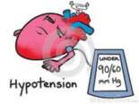 A hypertension B bradycardia C hypotension D tachycardia 33 What type of - photo 19