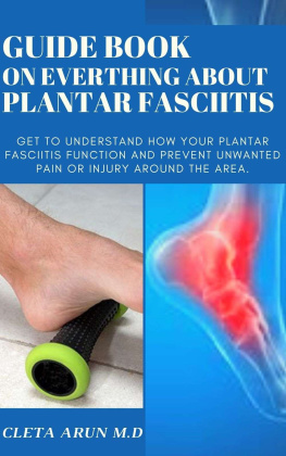 ARUN M.D GUIDE BOOK ON EVERYTHING ABOUT PLANTAR FASCIITIS: Get to Understand How Your Plantar Fasciitis Function and Prevent Unwanted Pain or Injury Around the Area.