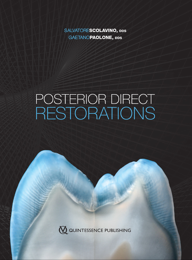 Posterior Direct Restorations First published as Restauri diretti nei - photo 1