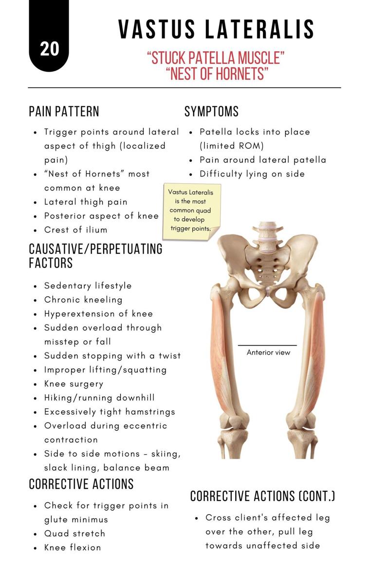 A Bodyworkers Guide to Soft Tissue Pain Patterns - photo 25