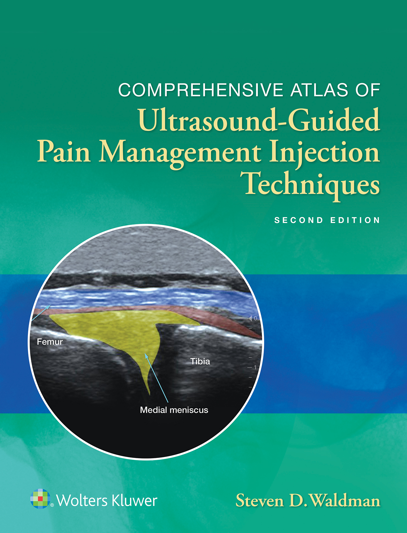 COMPREHENSIVE ATLAS OF Ultrasound-Guided Pain Management Injection Techniquess - photo 1