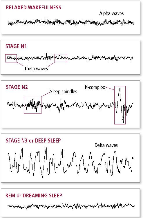 Brain waves change dramatically during the different stages of sleep Stage - photo 3