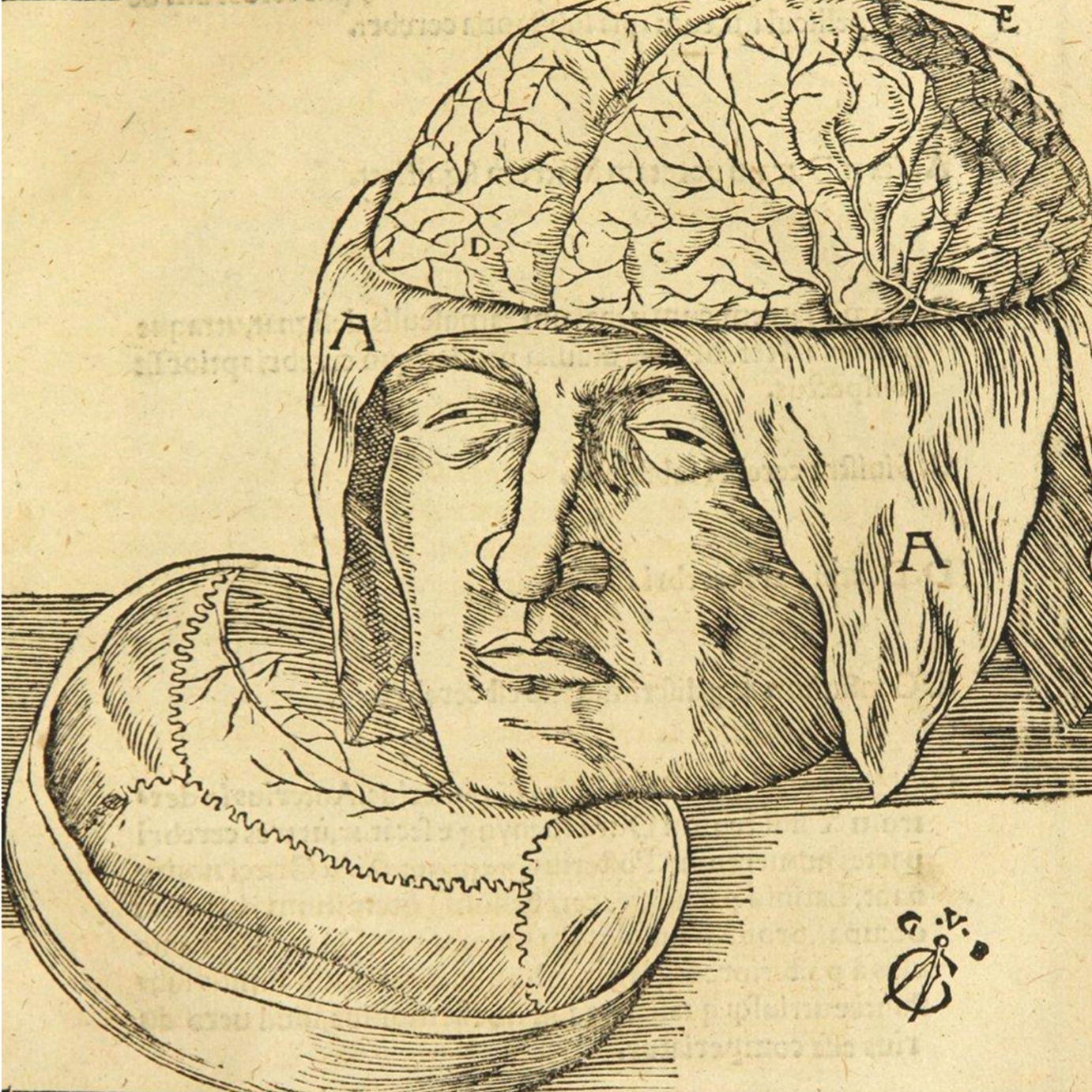 Fig 14 Drawings of the human skull illustrating the sutures of the calvaria - photo 6