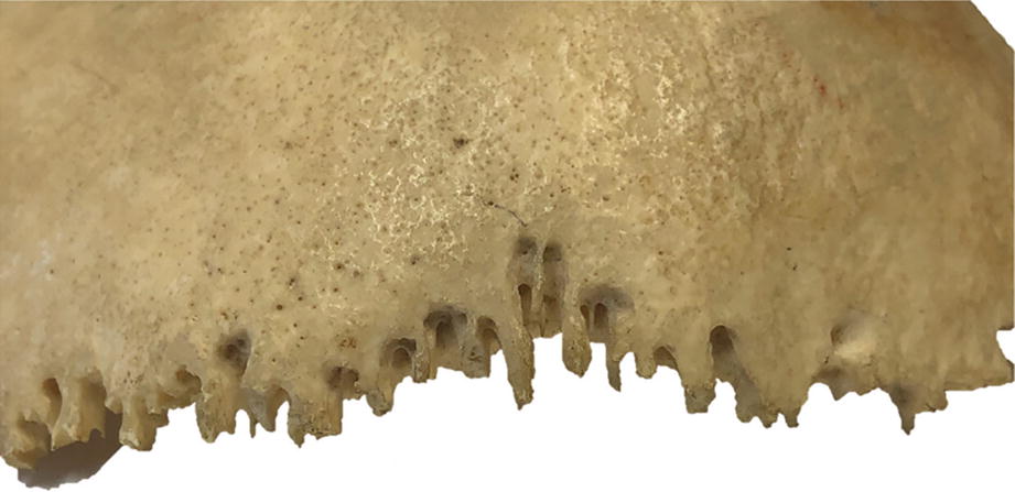 Fig 17 External view of the right half of the sagittal suture from a - photo 9