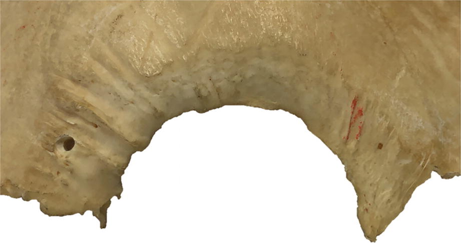 Fig 18 External view of the right parietal part of the squamous suture from a - photo 10