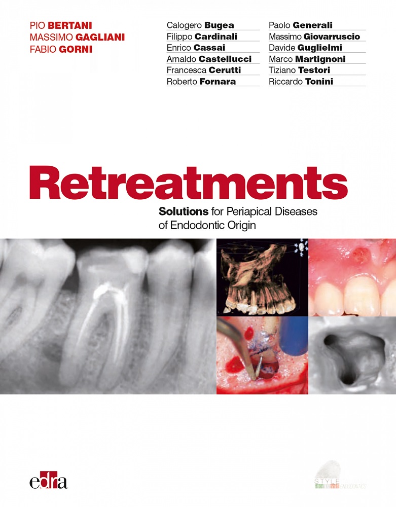 Retreatments Solutions for Periapical Diseases of Endodontic Origin PIO - photo 1