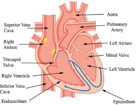 Figure 1 Basic Anatomy of the Heart If the coronary arteries of the heart - photo 5