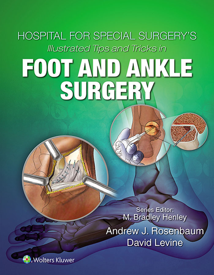 Hospital for Special Surgerys Illustrated Tips and Tricks in Foot and Ankle - photo 1