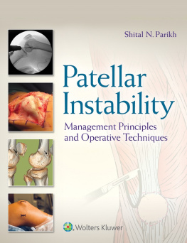 Dr. Shital N Parikh MD (editor) Patellar Instability: Management Principles and Operative Techniques