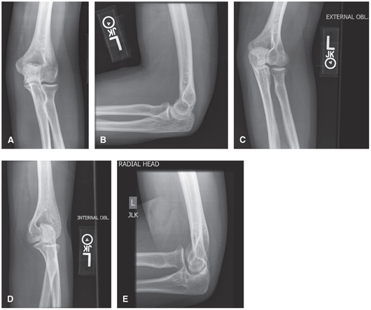 FIGURE 10 A AP B Lateral C Lateral external or radial oblique D - photo 10