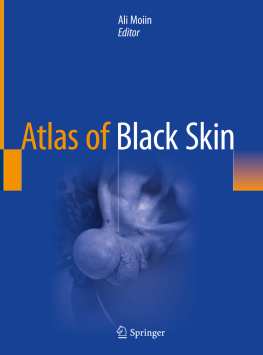 Ali Moiin (editor) - Atlas of Black Skin