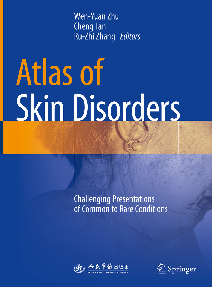 Editors Wen-Yuan Zhu Cheng Tan and Ru-Zhi Zhang Atlas of Skin Disorders - photo 1