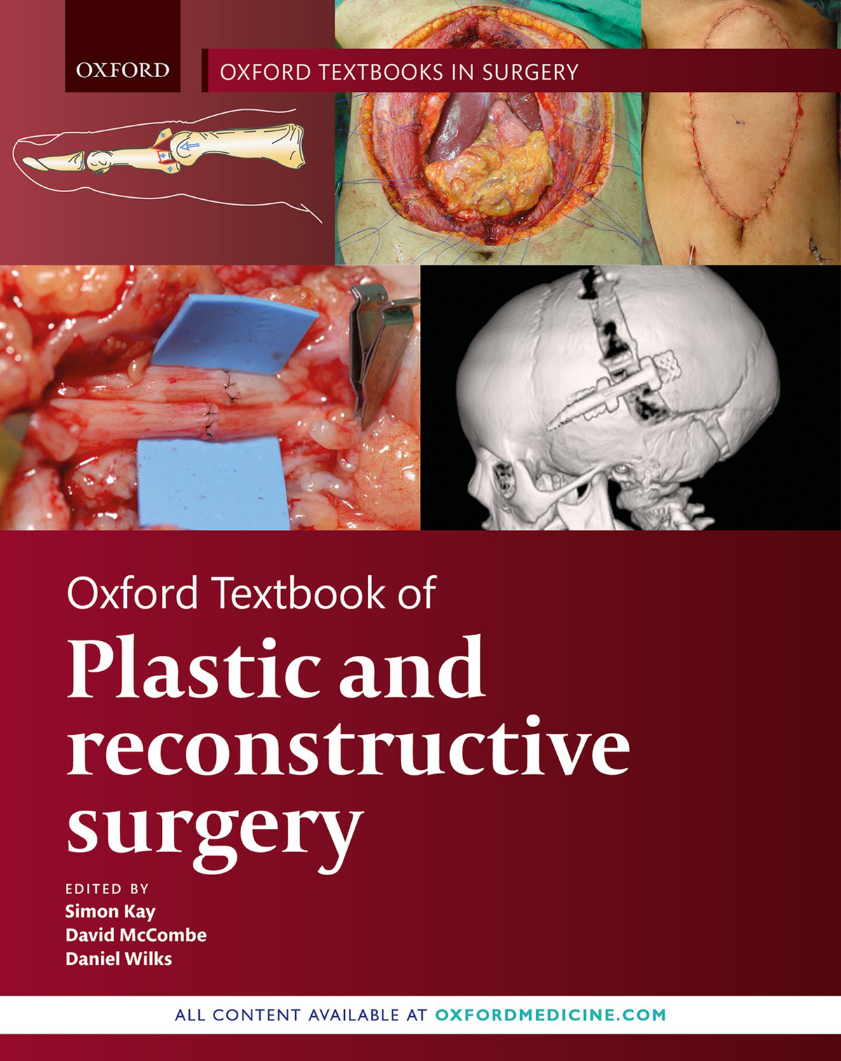 Oxford Textbook of Plastic and Reconstructive Surgery OXFORD TEXTBOOKS IN - photo 1