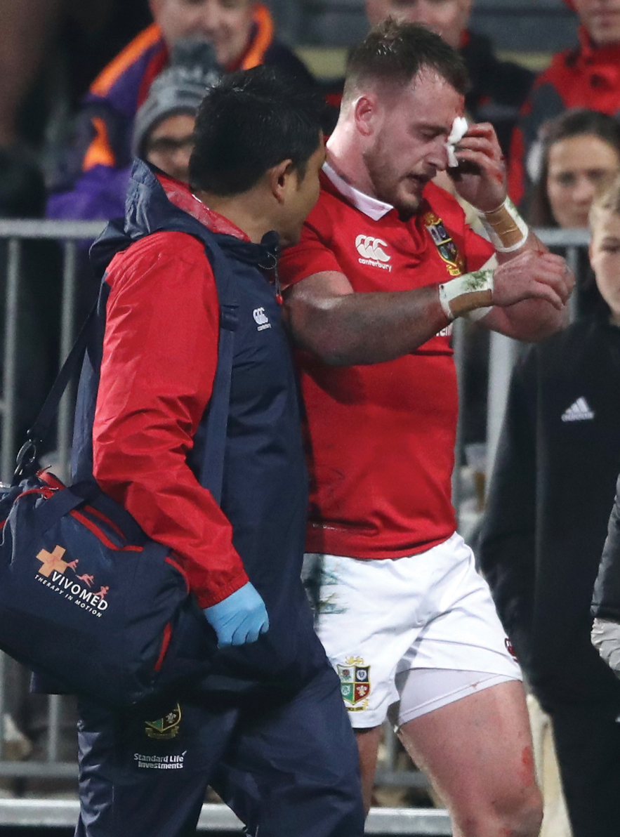 Stuart Hogg after suffering a tour-ending facial fracture in a collision with - photo 6