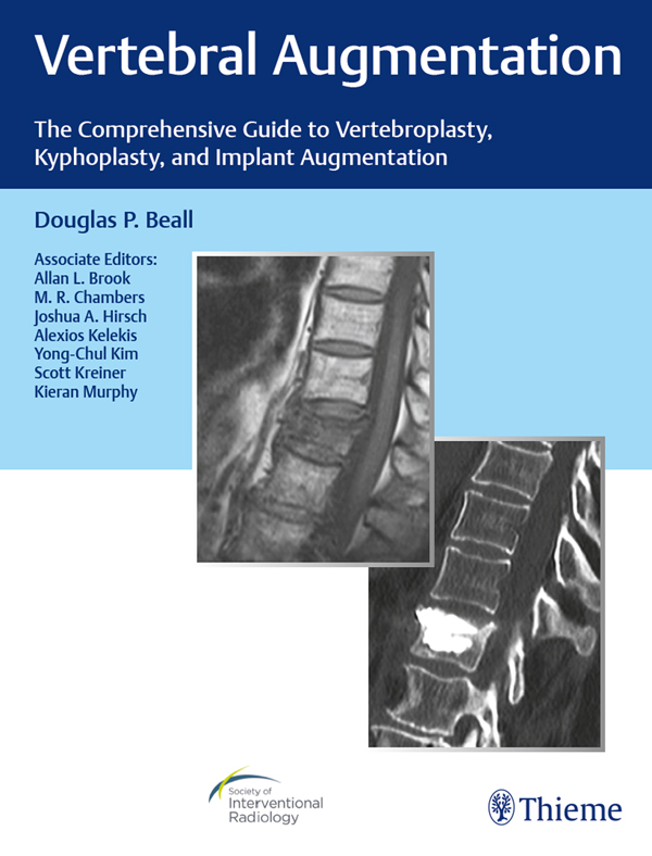 Vertebral Augmentation The Comprehensive Guide to Vertebroplasty - photo 1